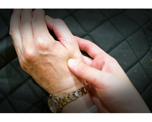 Why-does-contracture-occur
